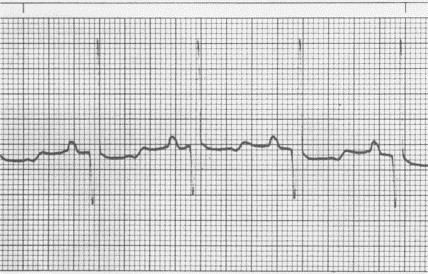 Figure 4-25