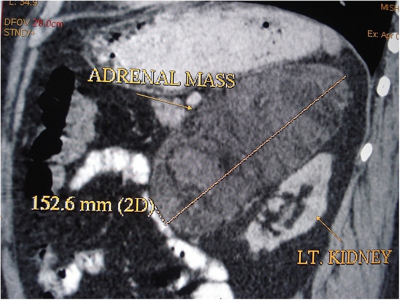 Figure 1