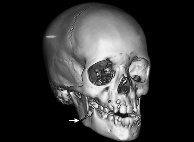 Fig. 3: