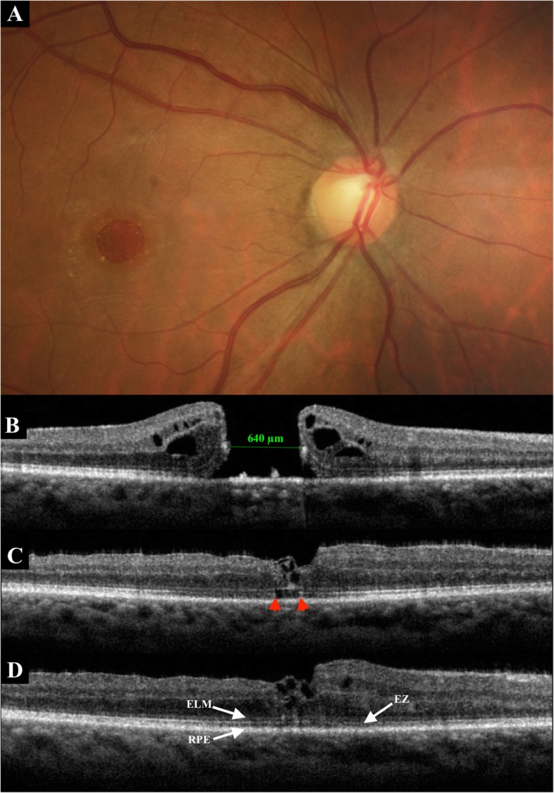 Fig. 1