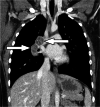 Fig. 20