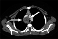 Fig. 23