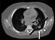 Fig. 16