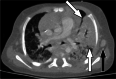 Fig. 12