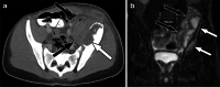 Fig. 27