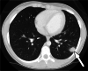 Fig. 14