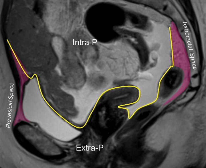 Figure 3b.