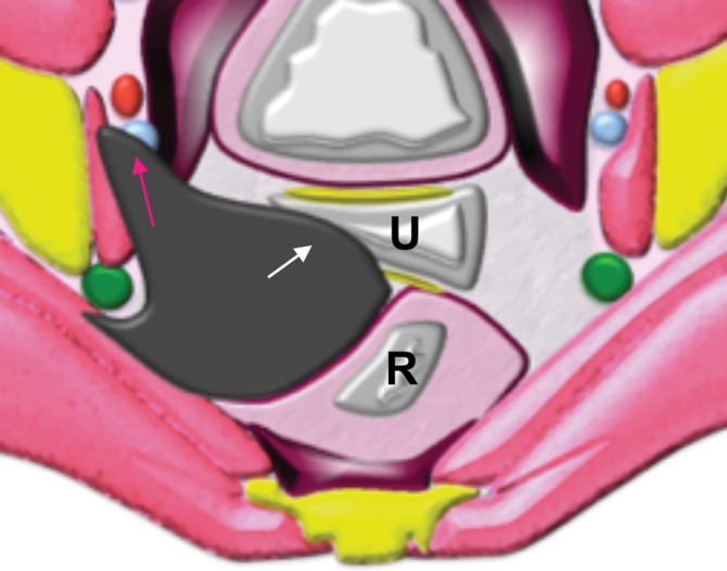 Figure 4d.