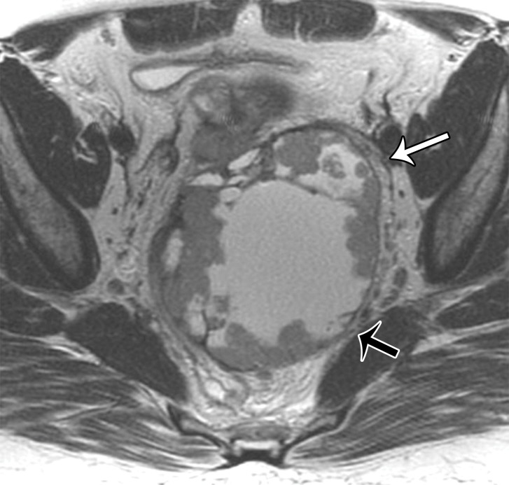 Figure 24b.