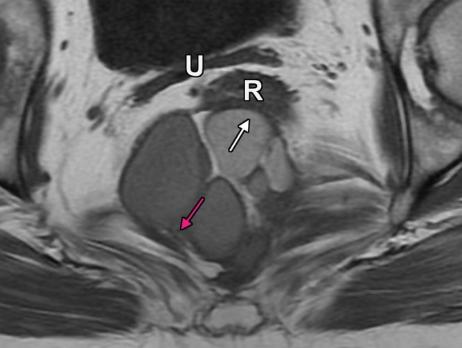 Figure 4a.