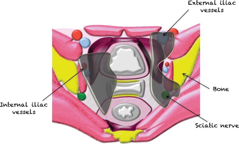 Figure 24a.