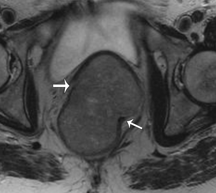 Figure 22c.