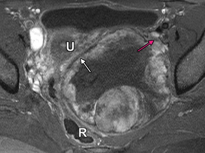 Figure 4b.