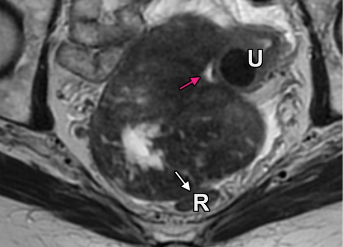 Figure 5b.