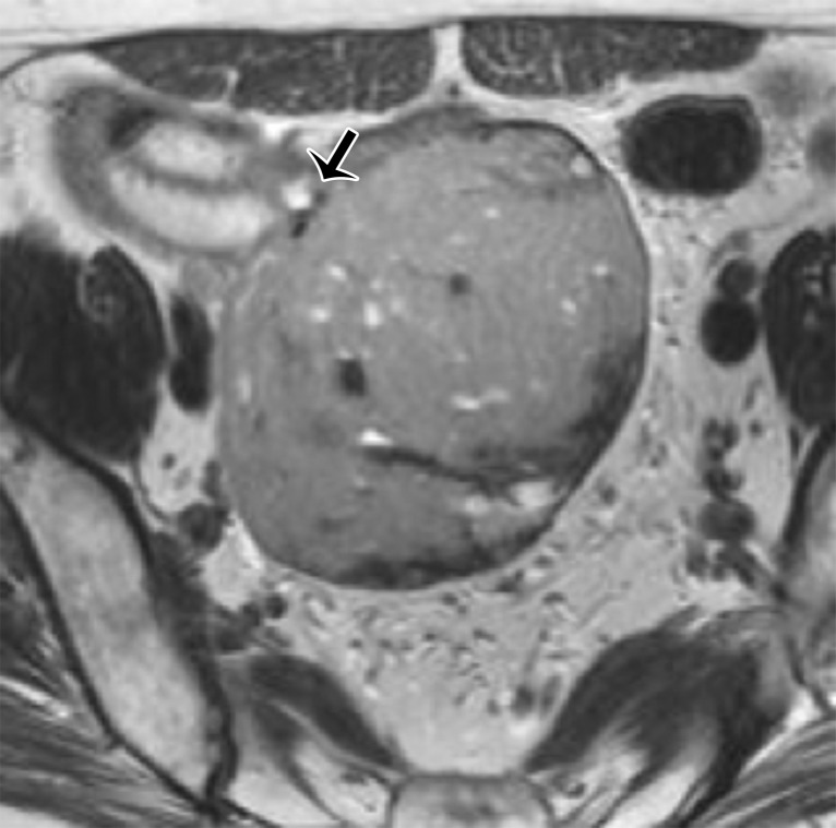 Figure 9b.