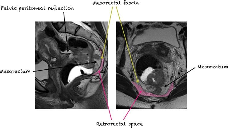 Figure 14.