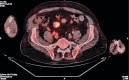 Fig. 2