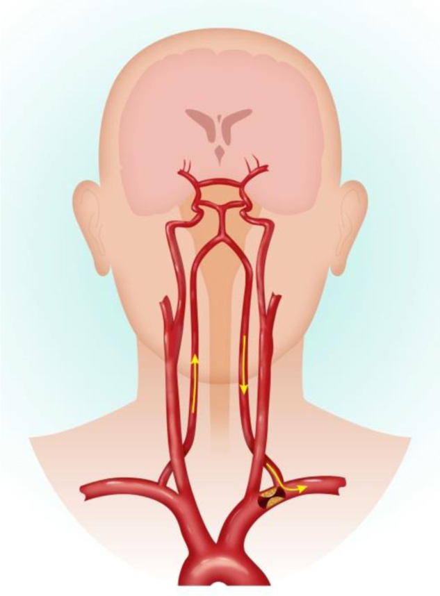 Fig. 1