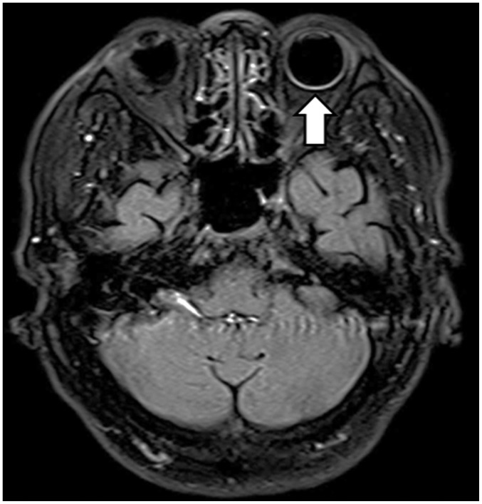 Fig. 16