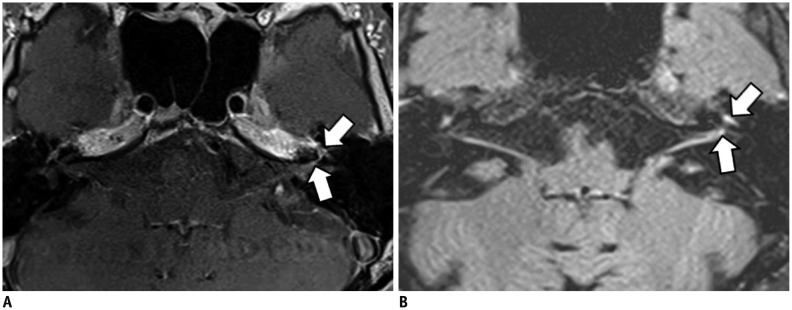 Fig. 13