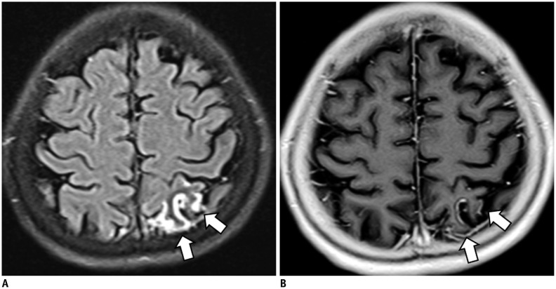 Fig. 17