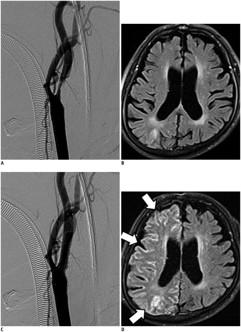 Fig. 15