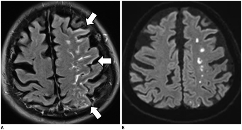 Fig. 14