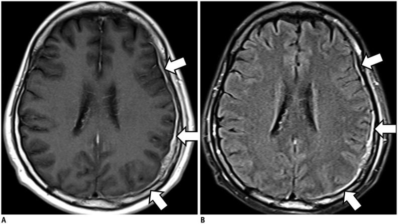 Fig. 11