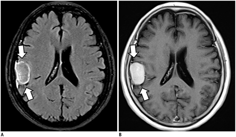 Fig. 12