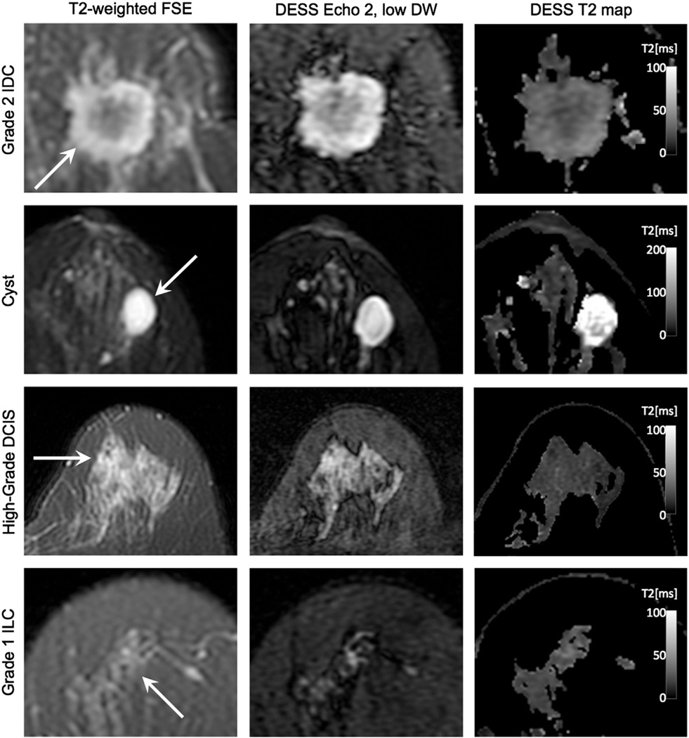 Fig. 11