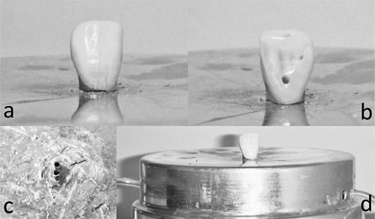 Figure 2. . A sample incisor positioned on the temperature measurement apparatus (d); the buccal side of the incisor (a); the palatal side of the incisor, drilled to place the thermocouple (b); and the tips of the water circulation pipes on the apparatus (c).