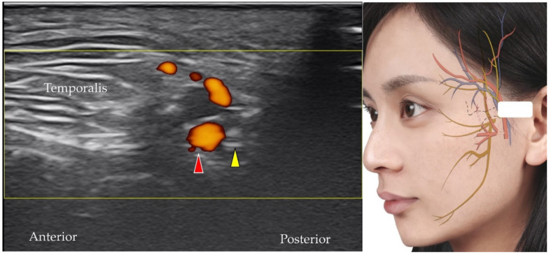 Figure 16