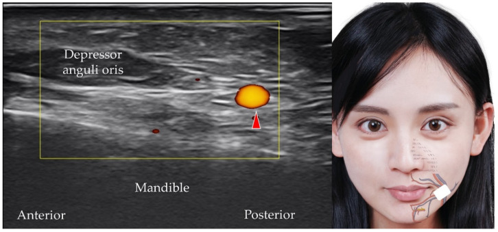 Figure 18