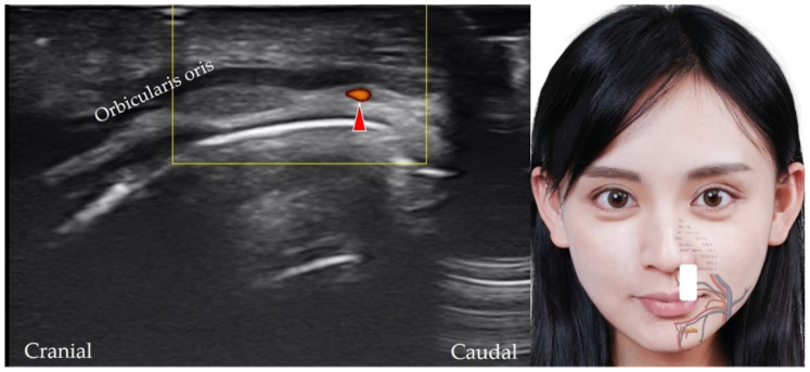 Figure 11