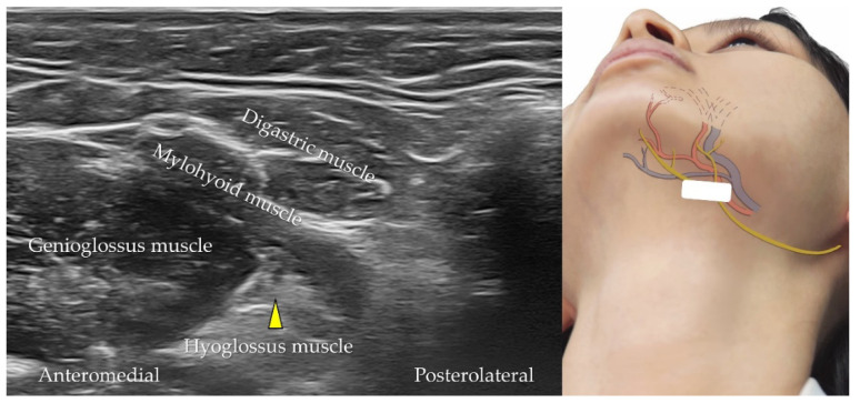 Figure 22