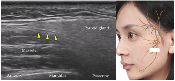 Figure 17