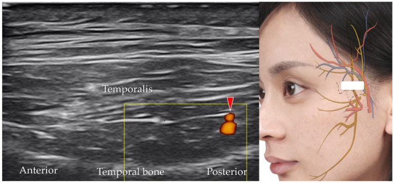 Figure 15