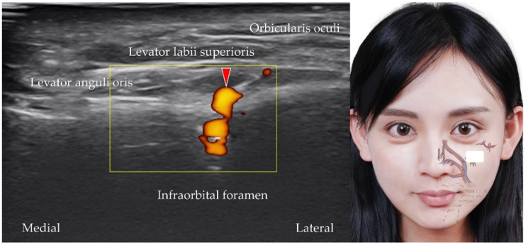 Figure 12