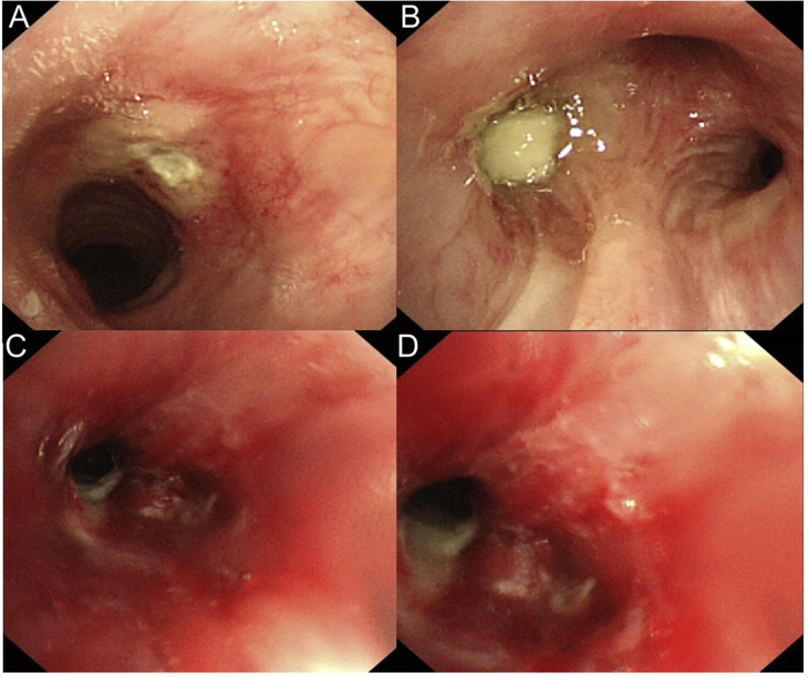 Fig. 4