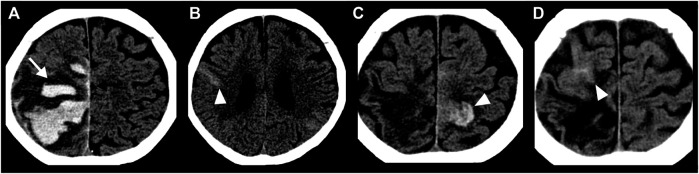 FIGURE 1