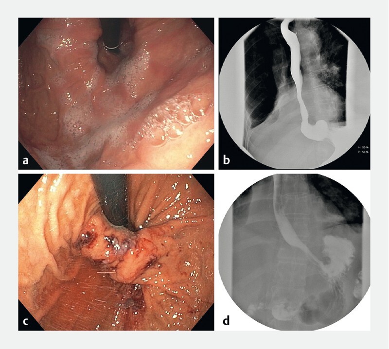 Fig. 1 a