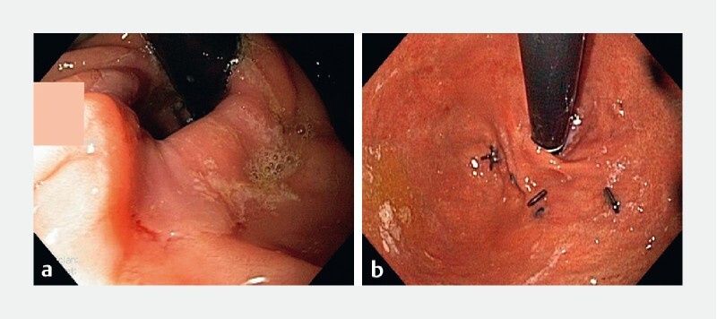 Fig. 2 a