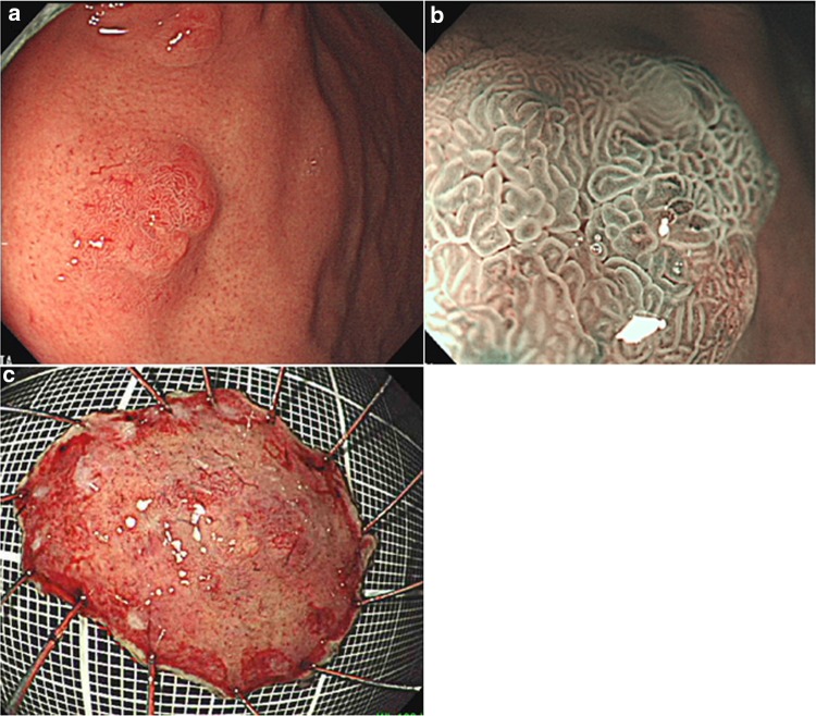 Fig. 3