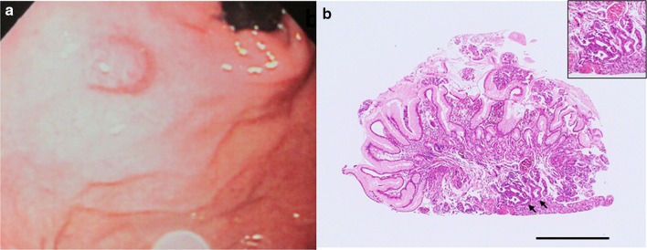 Fig. 1