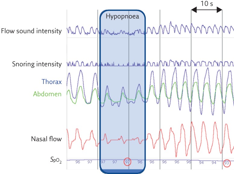 Figure 4