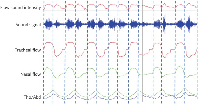 Figure 1