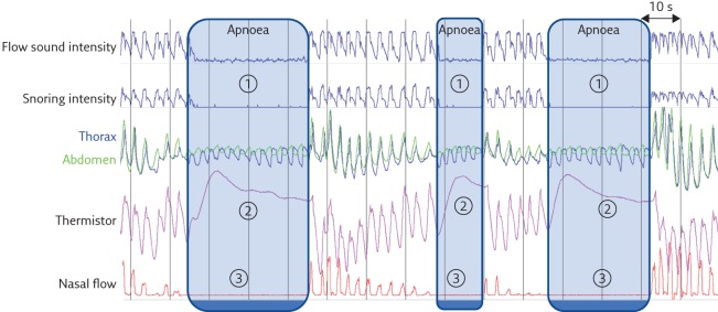 Figure 3