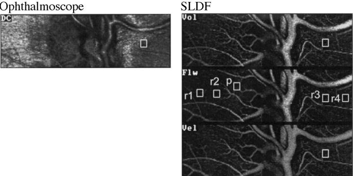 Figure 1  