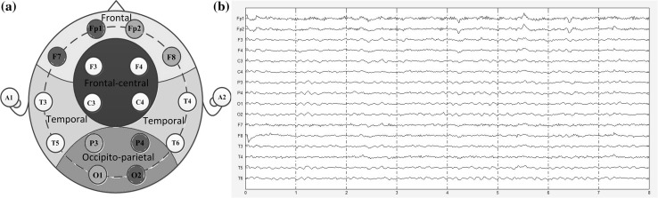 Fig. 1