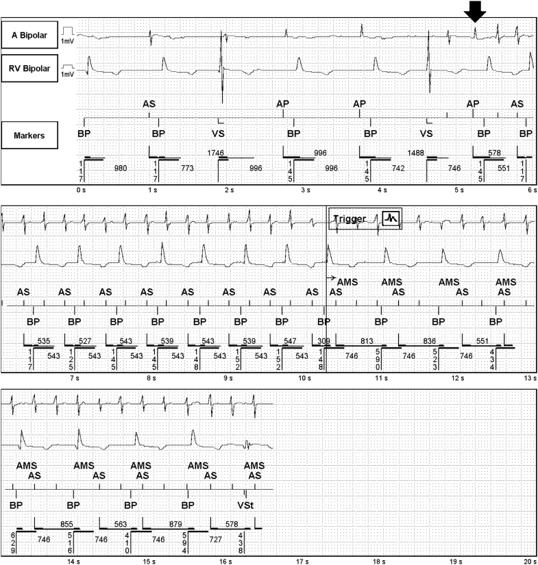 Figure 1